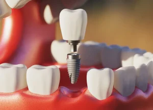 Dental Care